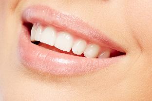 Blanchiment des dents centre dentaire Noisy-le-Sec