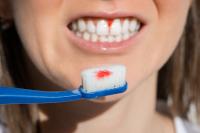saignement implant dentaire noisy le sec